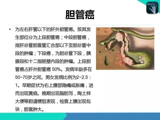 【PPT】胆道系统影像诊断