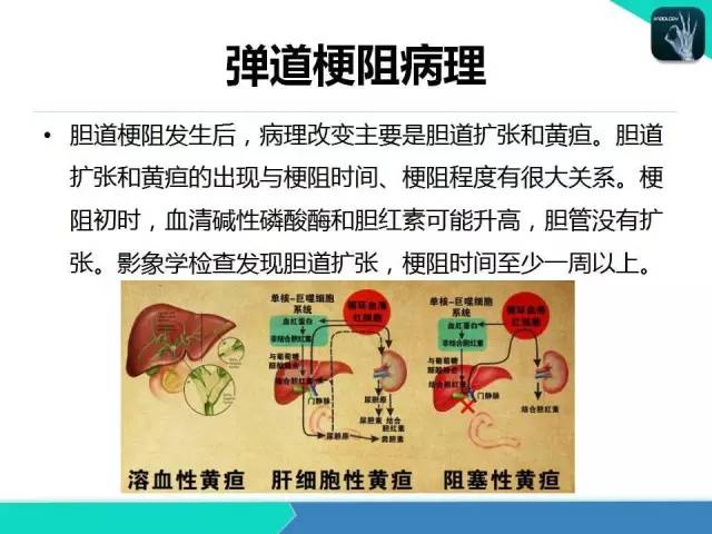 【PPT】胆道系统影像诊断