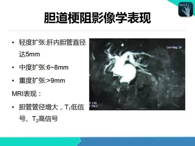 【PPT】胆道系统影像诊断