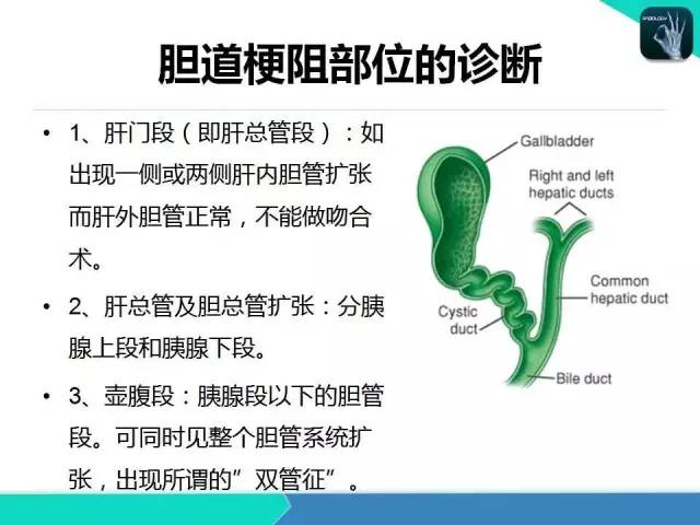【PPT】胆道系统影像诊断