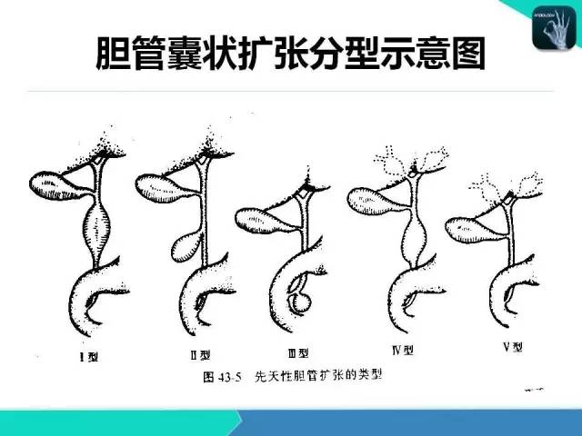 【PPT】胆道系统影像诊断