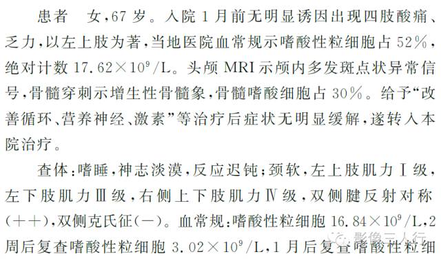 【病例】原发性嗜酸性粒细胞增多综合征脑病1例MR