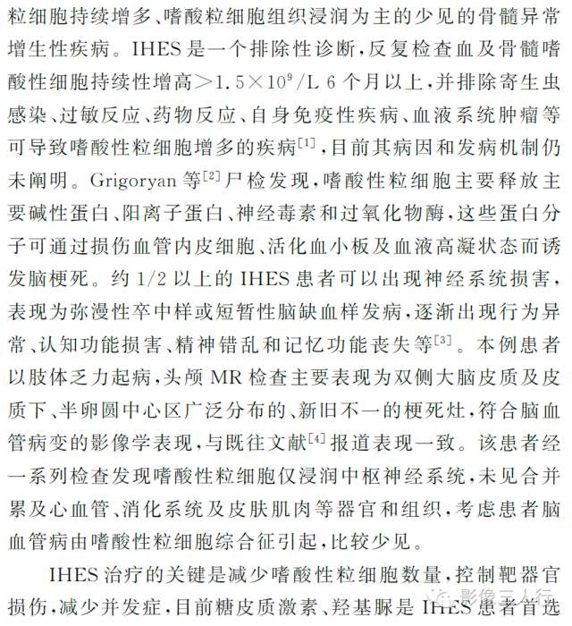 【病例】原发性嗜酸性粒细胞增多综合征脑病1例MR