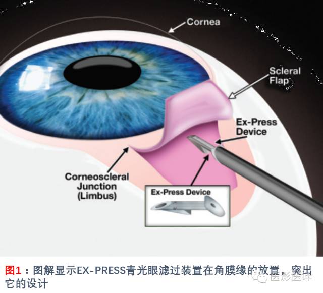眼眶内容物术后影像学表现 眼眶内容物术后影像学表现