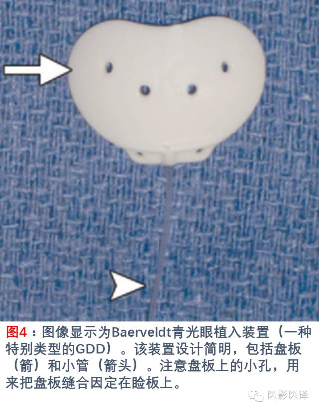 眼眶内容物术后影像学表现 眼眶内容物术后影像学表现