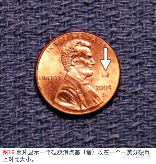 眼眶内容物术后影像学表现 眼眶内容物术后影像学表现