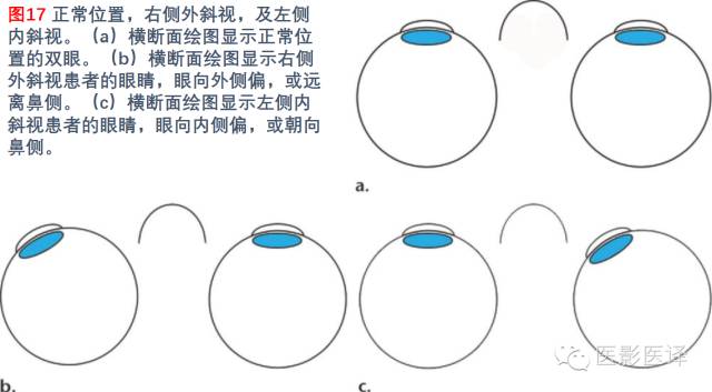 眼眶内容物术后影像学表现 眼眶内容物术后影像学表现
