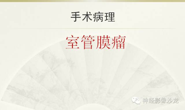 【病例】四脑室室管膜瘤1例CT影像表现