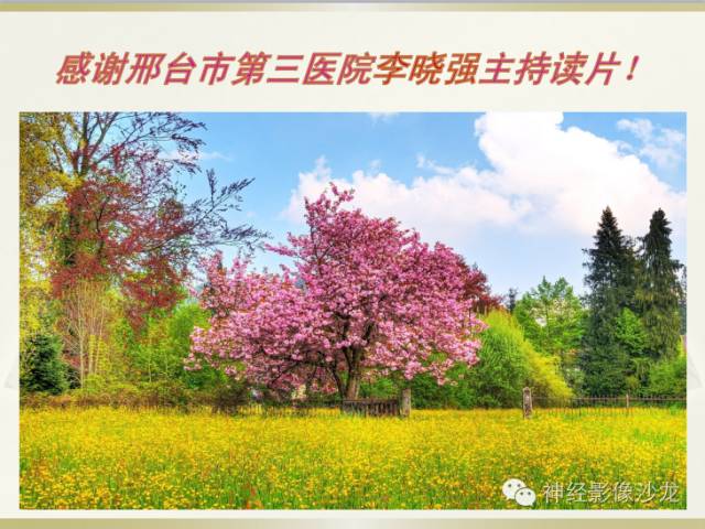 【病例】四脑室室管膜瘤1例CT影像表现