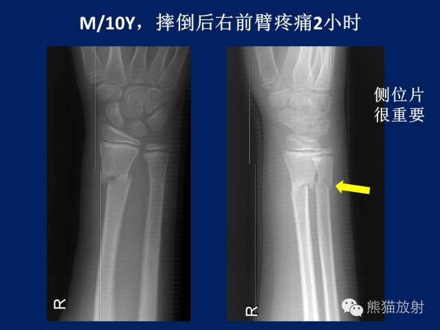 【PPT】骨关节影像学检查技术要求与诊断要点