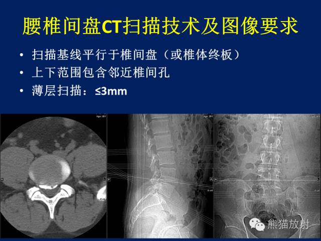 【PPT】骨关节影像学检查技术要求与诊断要点