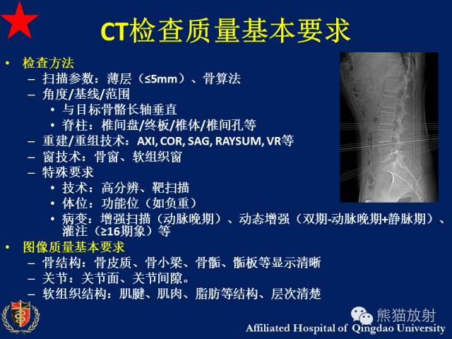 【PPT】骨关节影像学检查技术要求与诊断要点