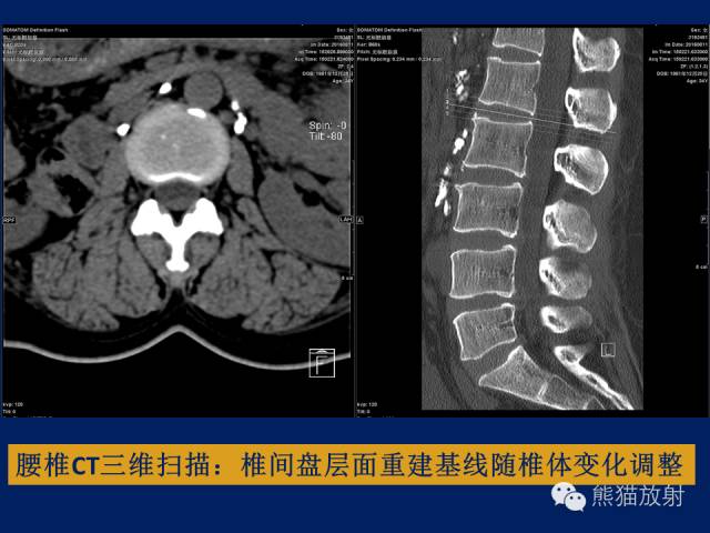 【PPT】骨关节影像学检查技术要求与诊断要点