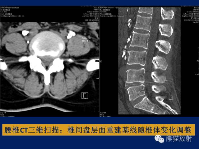 【PPT】骨关节影像学检查技术要求与诊断要点