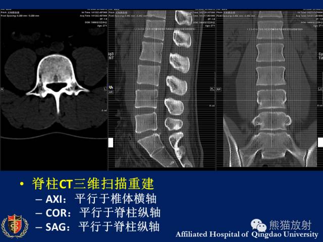 【PPT】骨关节影像学检查技术要求与诊断要点