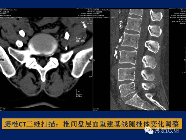 【PPT】骨关节影像学检查技术要求与诊断要点