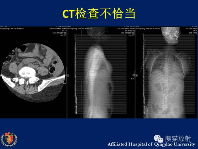 【PPT】骨关节影像学检查技术要求与诊断要点