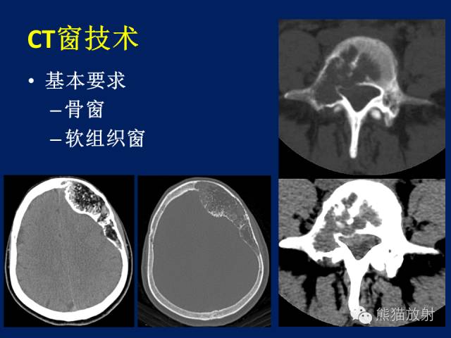 【PPT】骨关节影像学检查技术要求与诊断要点