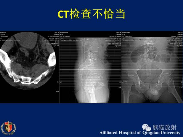 【PPT】骨关节影像学检查技术要求与诊断要点