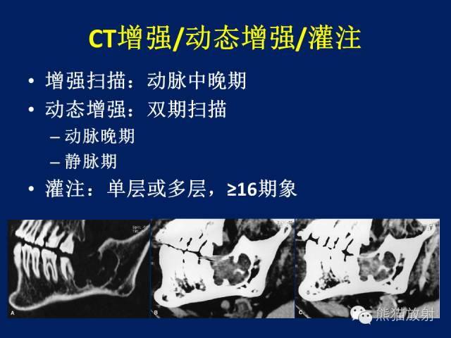 【PPT】骨关节影像学检查技术要求与诊断要点