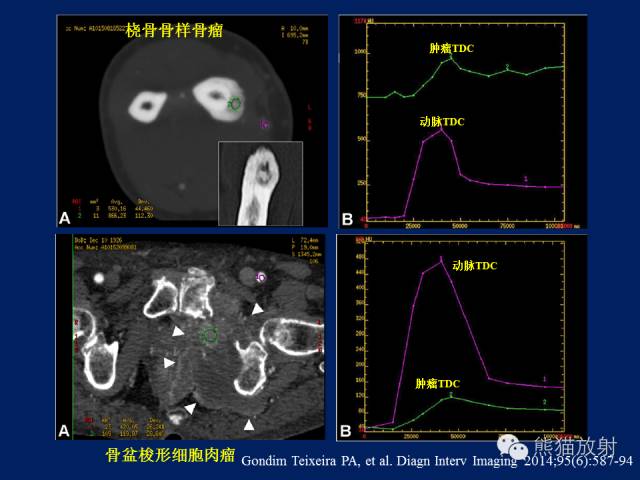 【PPT】骨关节影像学检查技术要求与诊断要点