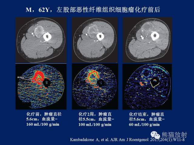 【PPT】骨关节影像学检查技术要求与诊断要点