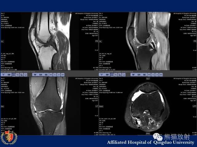 【PPT】骨关节影像学检查技术要求与诊断要点