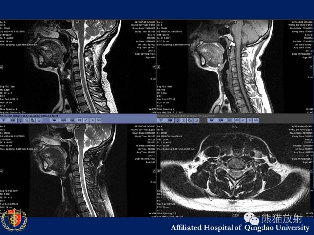 【PPT】骨关节影像学检查技术要求与诊断要点