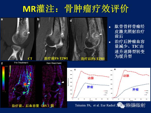 【PPT】骨关节影像学检查技术要求与诊断要点