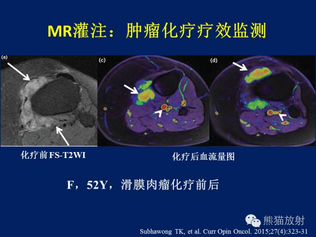 【PPT】骨关节影像学检查技术要求与诊断要点