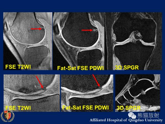 【PPT】骨关节影像学检查技术要求与诊断要点