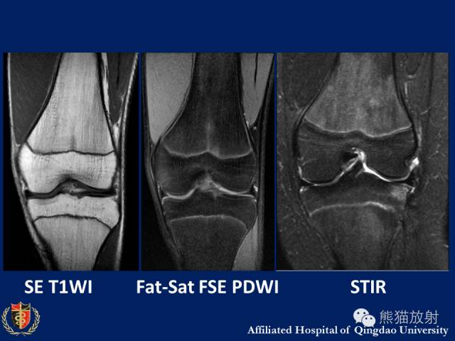 【PPT】骨关节影像学检查技术要求与诊断要点