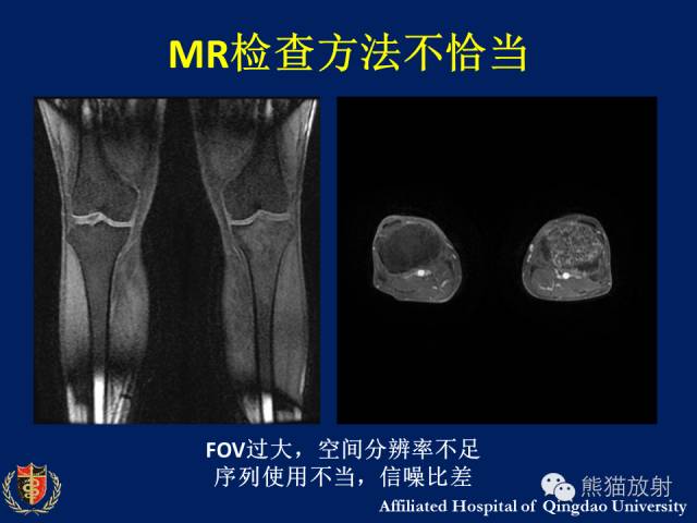 【PPT】骨关节影像学检查技术要求与诊断要点
