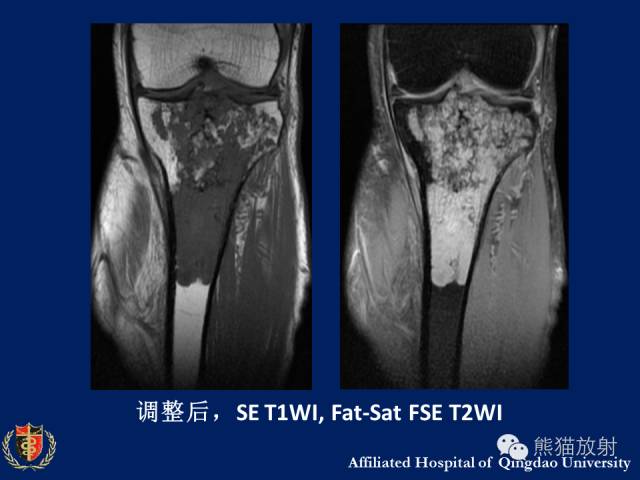 【PPT】骨关节影像学检查技术要求与诊断要点