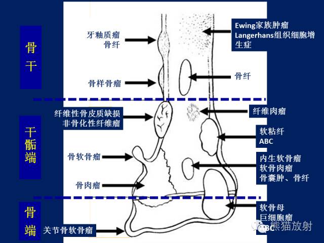 【PPT】骨关节影像学检查技术要求与诊断要点