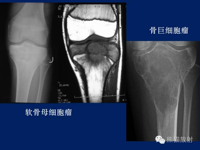 【PPT】骨关节影像学检查技术要求与诊断要点