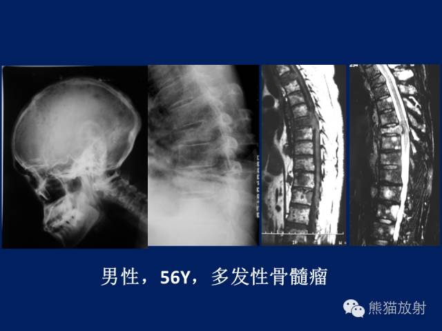 【PPT】骨关节影像学检查技术要求与诊断要点
