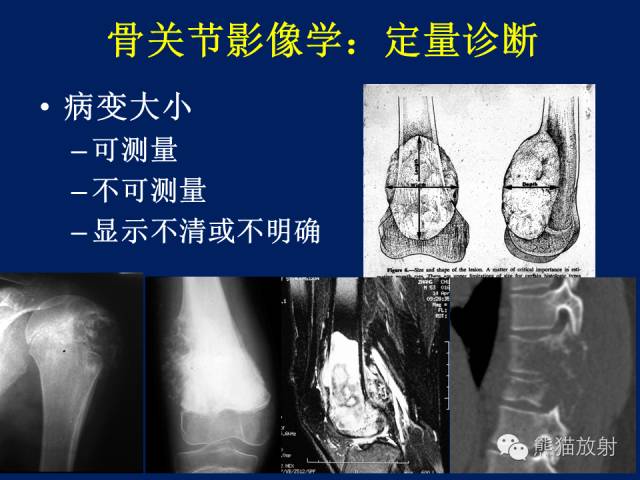 【PPT】骨关节影像学检查技术要求与诊断要点