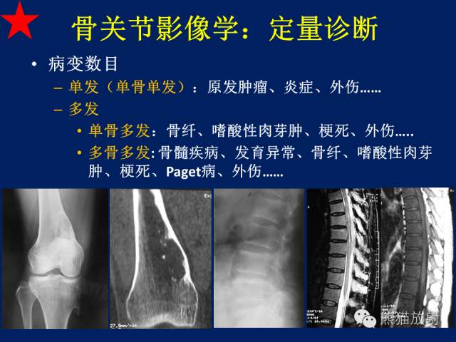 【PPT】骨关节影像学检查技术要求与诊断要点