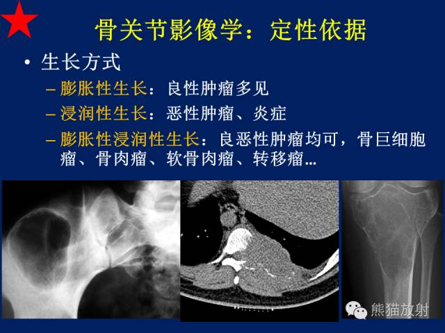 【PPT】骨关节影像学检查技术要求与诊断要点