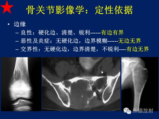 【PPT】骨关节影像学检查技术要求与诊断要点