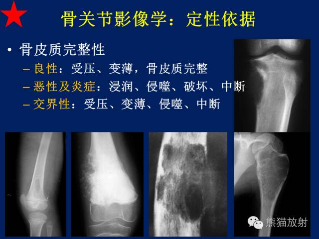 【PPT】骨关节影像学检查技术要求与诊断要点