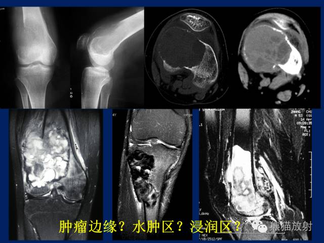 【PPT】骨关节影像学检查技术要求与诊断要点