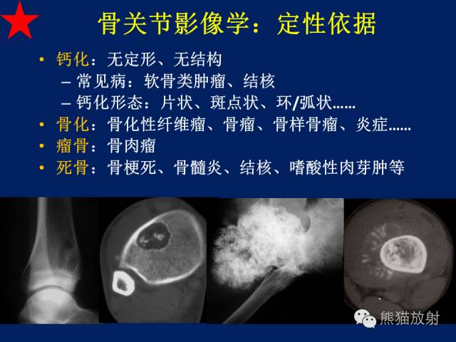 【PPT】骨关节影像学检查技术要求与诊断要点
