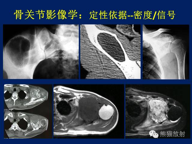 【PPT】骨关节影像学检查技术要求与诊断要点