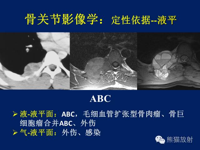 【PPT】骨关节影像学检查技术要求与诊断要点