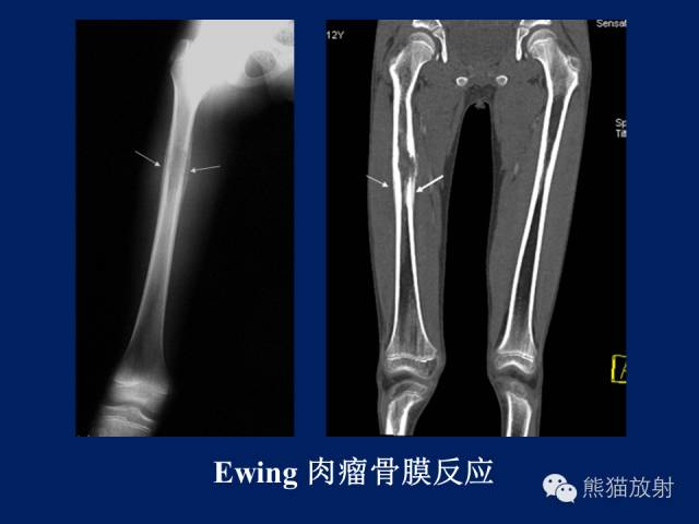 【PPT】骨关节影像学检查技术要求与诊断要点