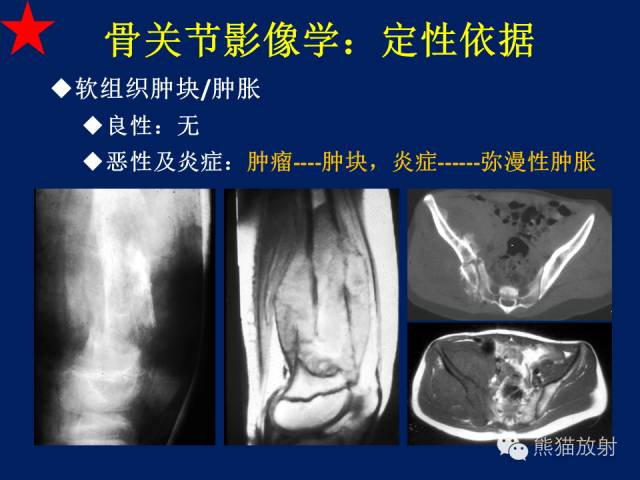 【PPT】骨关节影像学检查技术要求与诊断要点