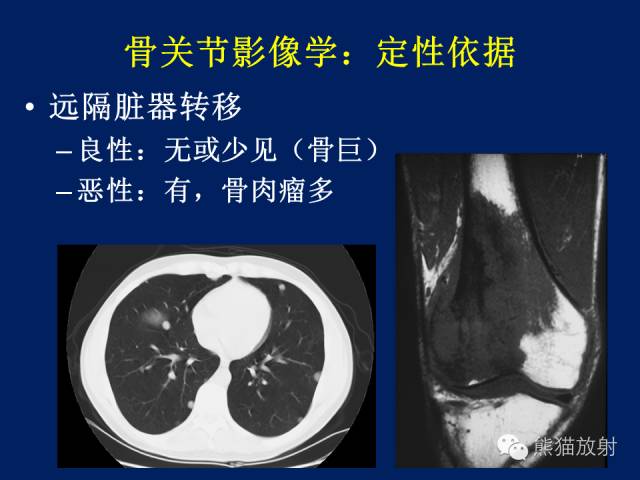 【PPT】骨关节影像学检查技术要求与诊断要点