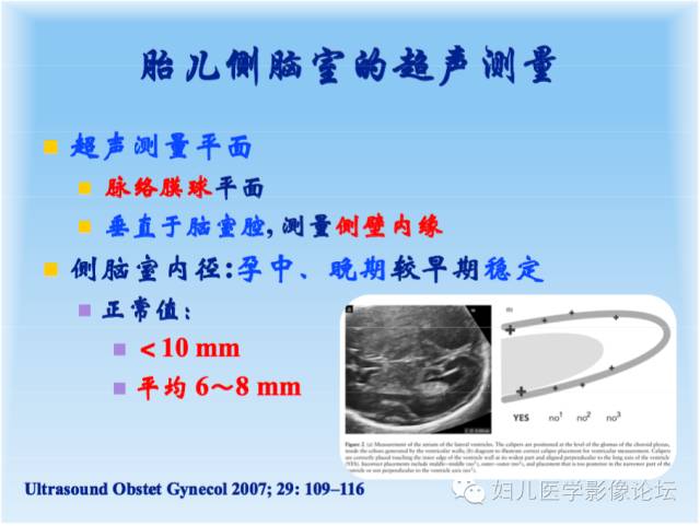 【PPT】胎儿颅脑常见先天异常MRI诊断